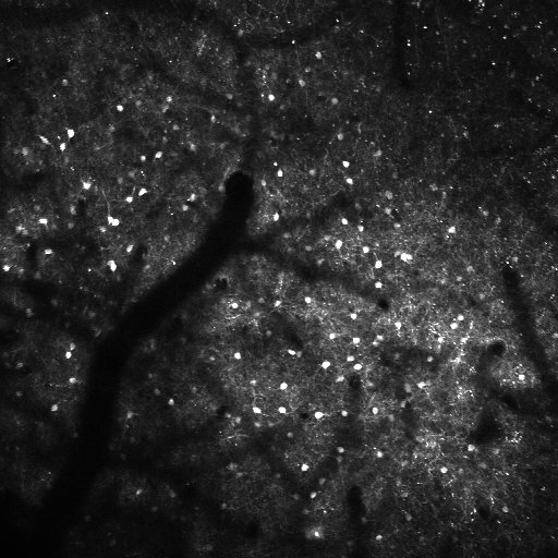 Article thumbnail: When Practice Makes Perfect: The Neurons Behind Skilled Movement