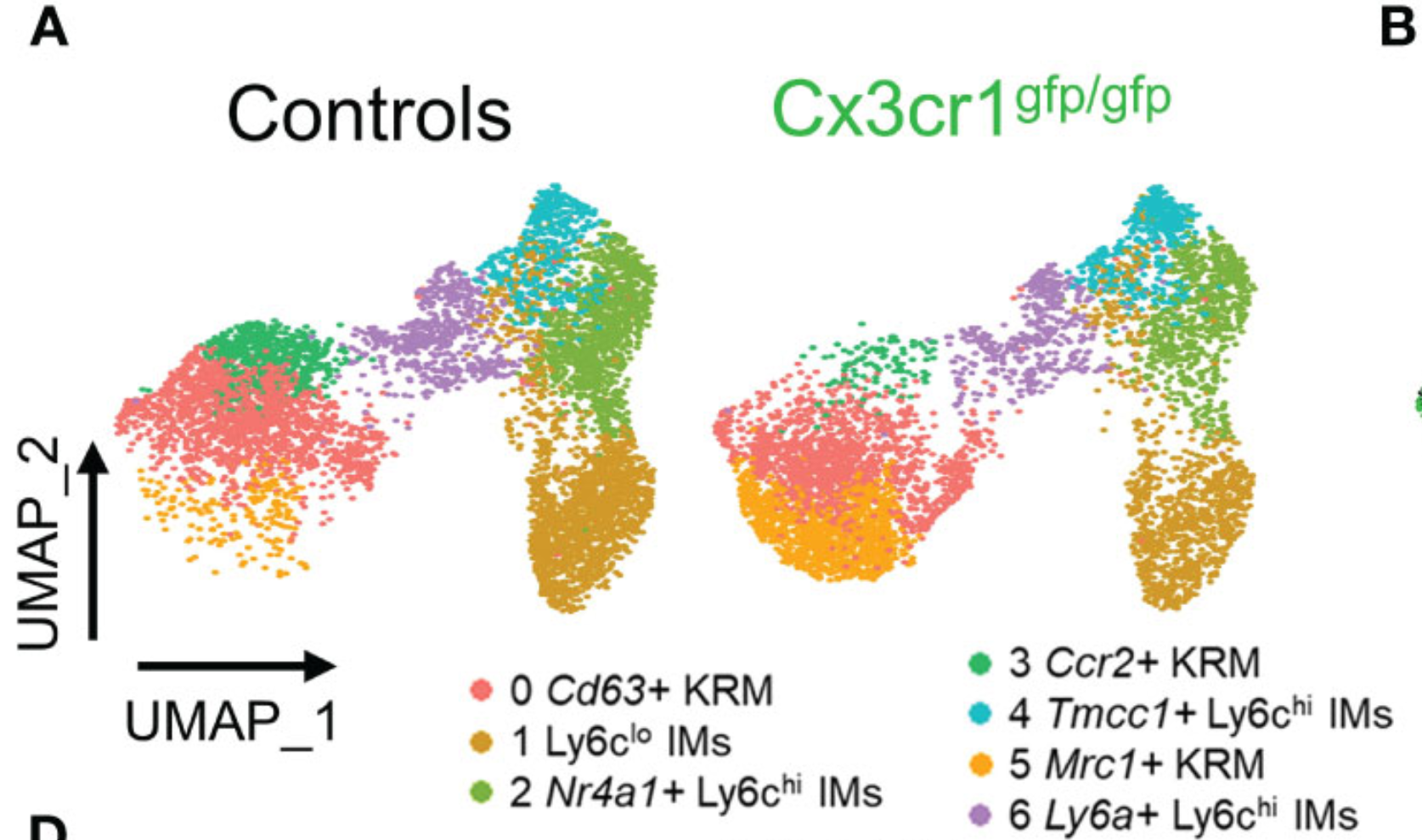 Article thumbnail: Cx3cr1 controls kidney resident macrophage heterogeneity