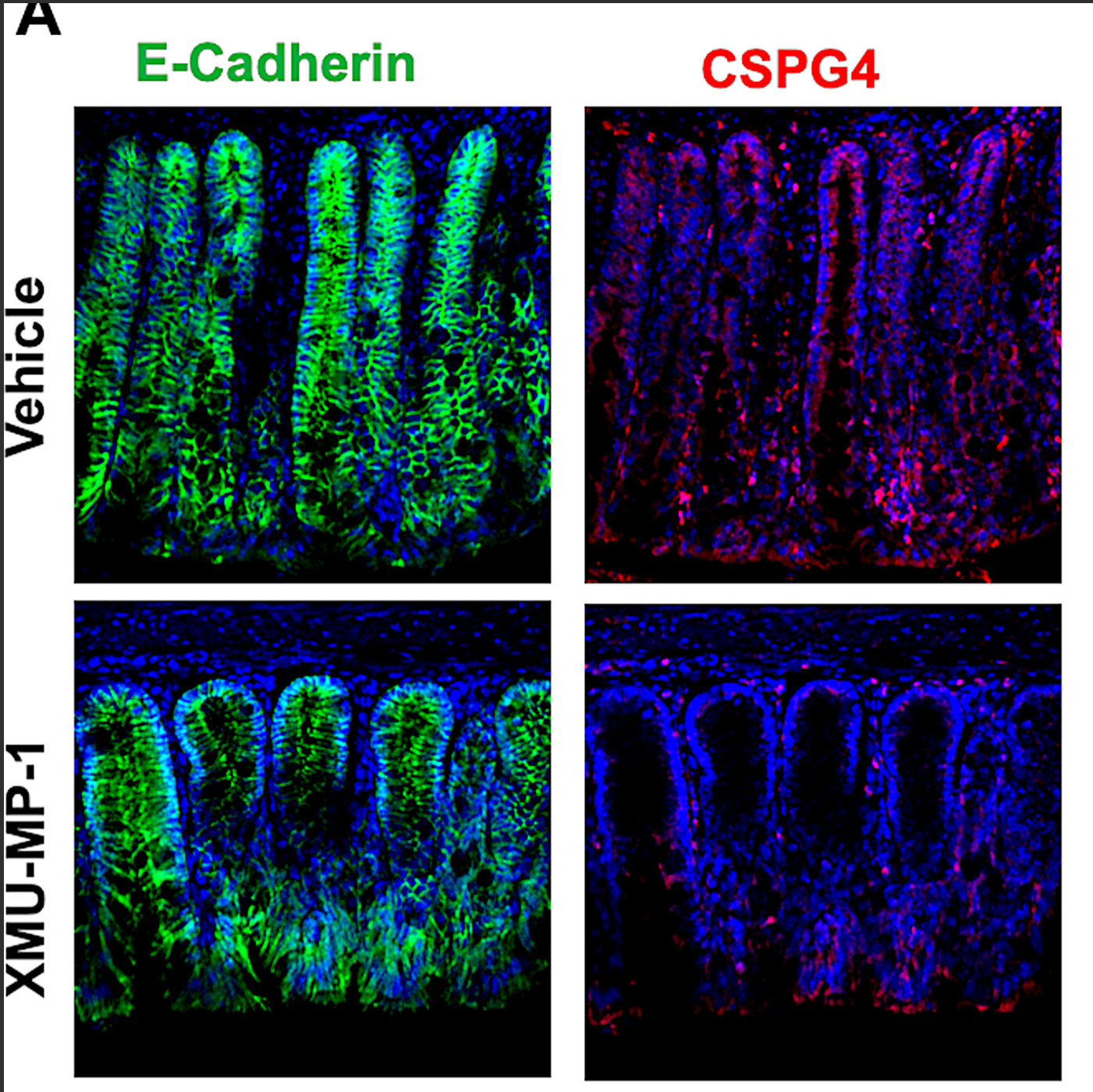 Article thumbnail: Discovery of Hippo signaling as a regulator of CSPG4 expression and as a therapeutic target for Clostridioides difficile disease